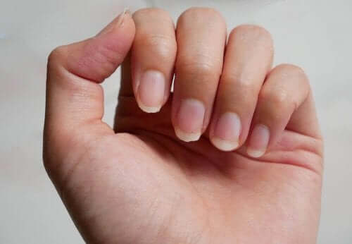 Nio bra botemedel mot sköra naglar 
