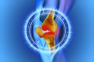 Knärehabilitering efter meniskoperation