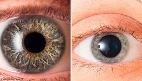 Olika typer av ögon.