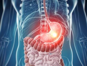 Dessa är de vanligaste livsmedelsintoleranserna