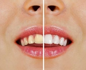 Naturliga produkter för att göra tänderna vitare