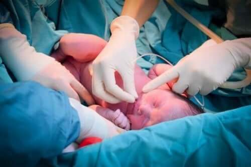 Risken för neonatal död är hög