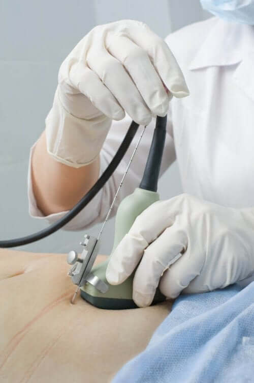 Ultraljudsundersökning av mage