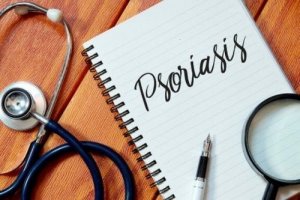 Fem positiva vanor när man har psoriasis