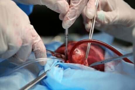 Läkare opererar hjärta