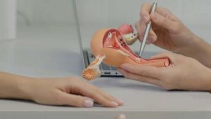 Behandling av polycystiskt ovarialsyndrom