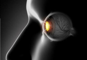 Skelande ögon: symptom och behandlingar