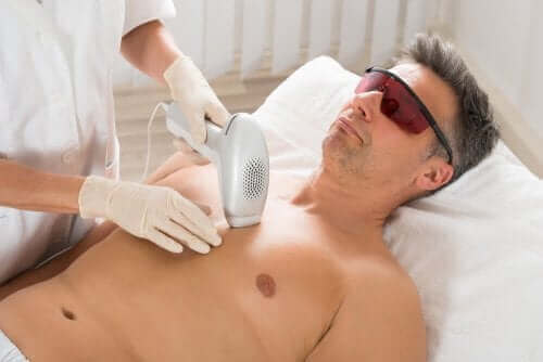 Hårborttagning med laser