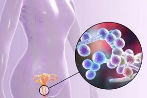 Vad bör man veta om vaginala jästinfektioner?