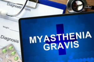 Fakta om myastenia gravis: vad innebär denna sjukdom?