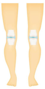 Olika typer av synovialleder i kroppen