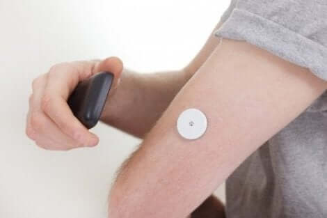Blodsockermätare för diabetiker kan implanteras