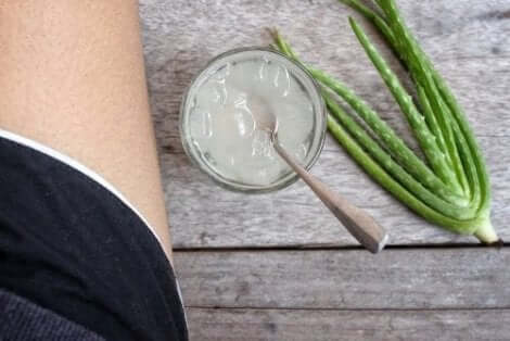 Aloe vera för brännskador