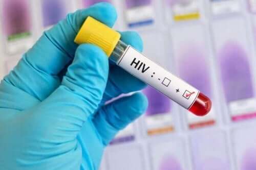 Blodprov för HIV