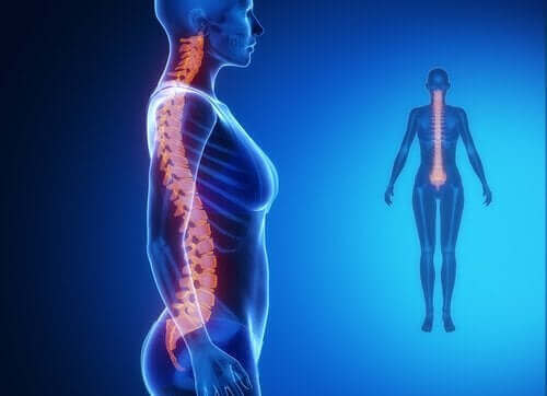 Diagnos och behandling av artros i ryggraden