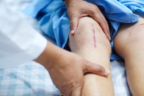 Återhämtning efter en knäprotesoperation
