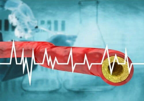 Håll ditt kolesterol i schack med hjälp av kosten