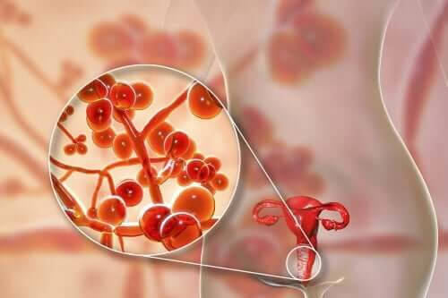 Mycoplasma Genitalium - orsaker, symptom och behandling