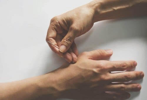 Akupunktur: någon sticker in akupunkturnål i hand