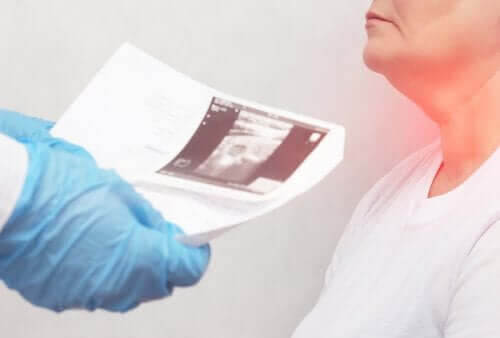 Knutor på sköldkörteln - symptom och orsaker