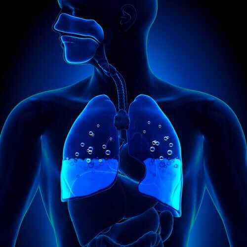 Symptom och orsaker till lungödem