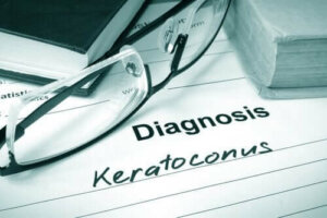 Symptom vid keratokonus samt hur man behandlar det