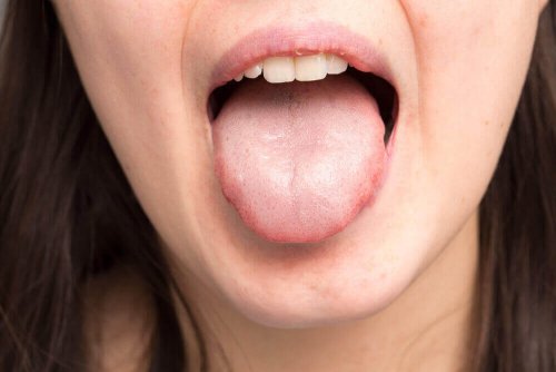 Kvinna med ett tjockt saliv sträcker ut tungan.