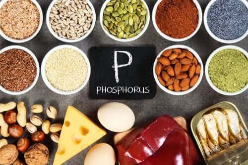 Hyperfosfatemi: en obalans i fosfornivåerna