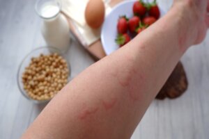 Allergisprutor - ett vaccin mot allergier