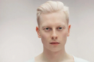 Olika typer av albinism - allt du behöver veta