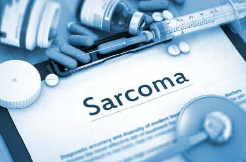 Fakta om sarkom och bindvävstumörer