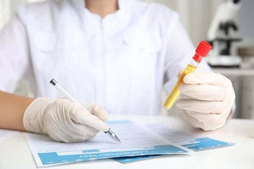 prover för att diagnostisera låga kreatininnivåer