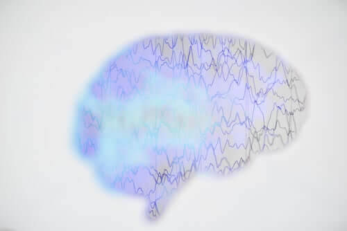 illustration av ett epileptiskt anfall