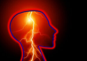 Vad är ett epileptiskt anfall och hur hanterar man det?
