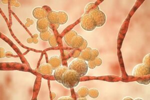 Allt du behöver veta om candida auris