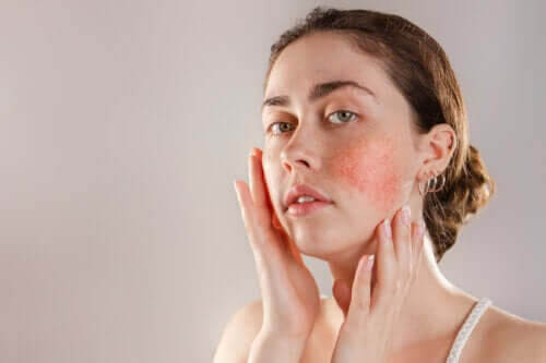 Reaktiv hud: symptom, orsaker och behandling