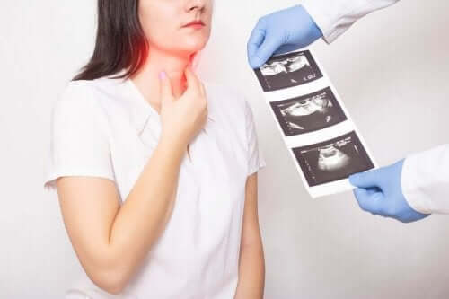 Symptom för sköldkörtelcancer och hur man behandlar det