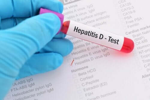 Blodprov för hepatit B