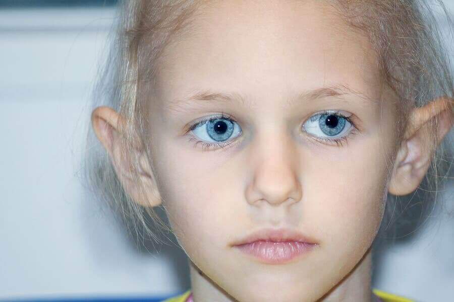 Ett barn med ögonsjukdomen retinoblastom