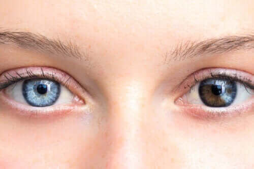 Förändringar i ögonfärgen kan vara orsak till oro