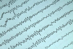 Så kombinerar du epilepsi och amning