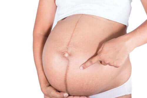 Gravid kvinna med linea nigra på magen.