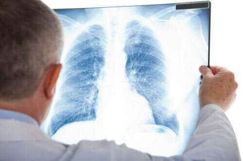 Symtom på atypisk lunginflammation