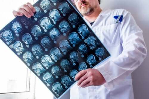 Doktor håller röntgenbild på ett huvud i handen.