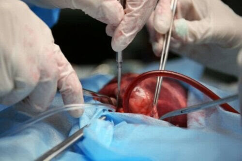 typer av hjärtsjukdomar: operation
