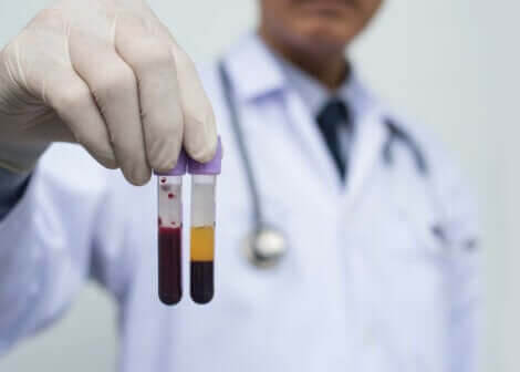 transfusioner av plasma