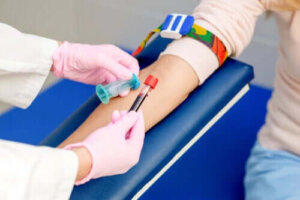 RPR-test för att diagnostisera syfilis