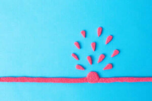 Aortaaneurysm i buken: symptom och behandling