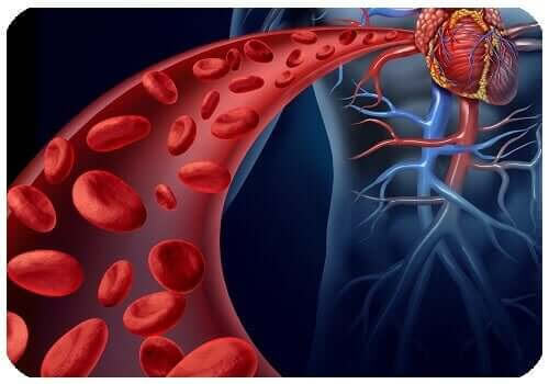 Aortaaneurysm i buken