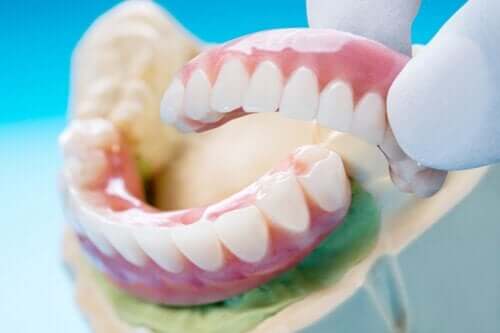 Fördelar och nackdelar med en tandbrygga